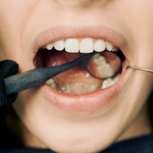 BESPLATAN pregled u dentalnoj klinici "Smile from Heart" Sarajevo.