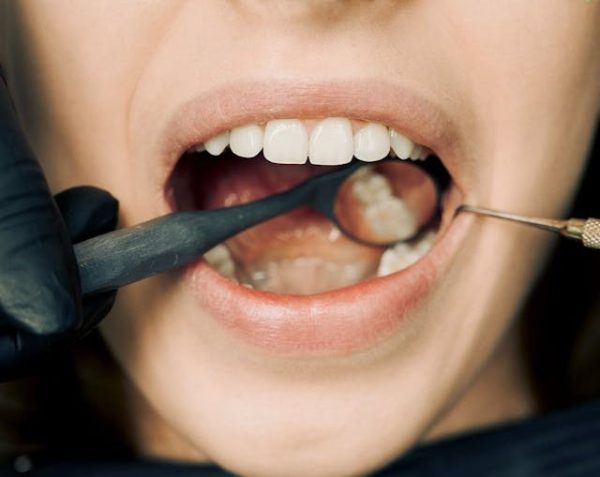 BESPLATAN pregled u dentalnoj klinici "Smile from Heart" Sarajevo.